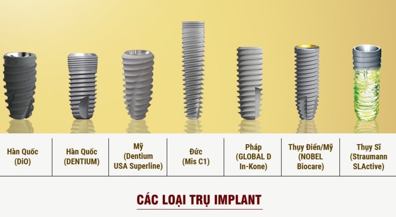 cac loai tru implant