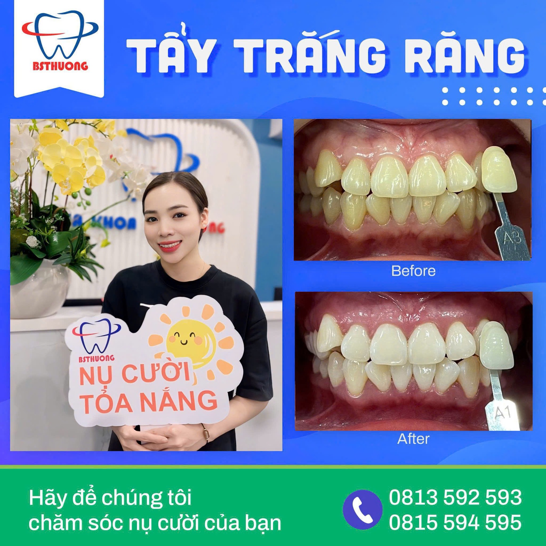 tay trang rang