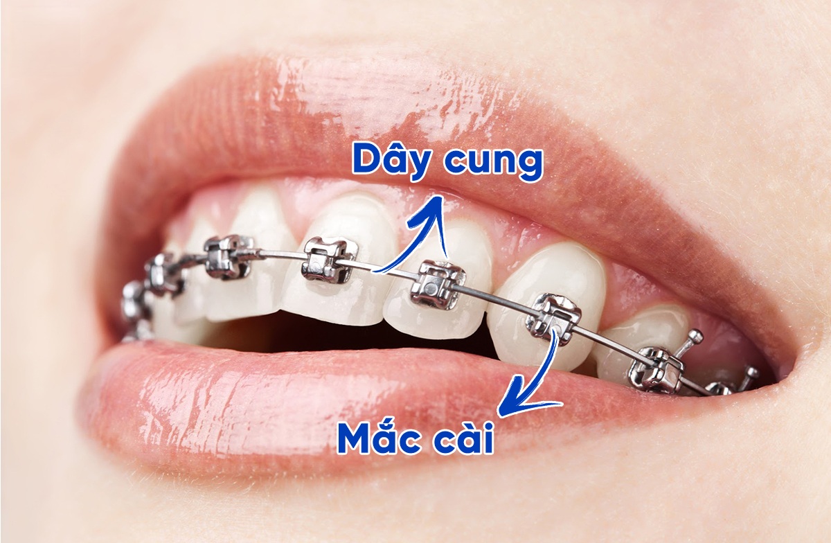 cac loai mac cai