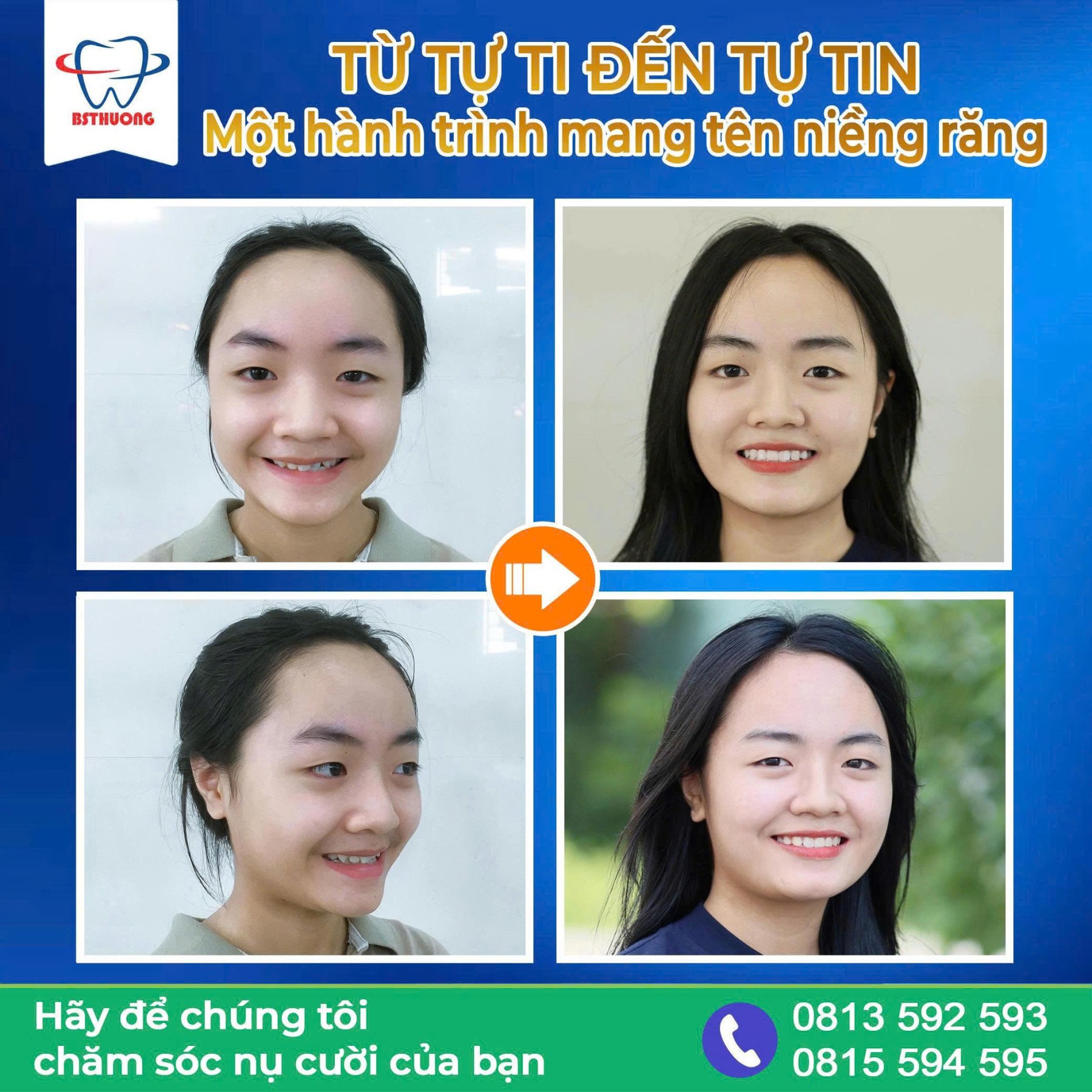 nieng rang tham my